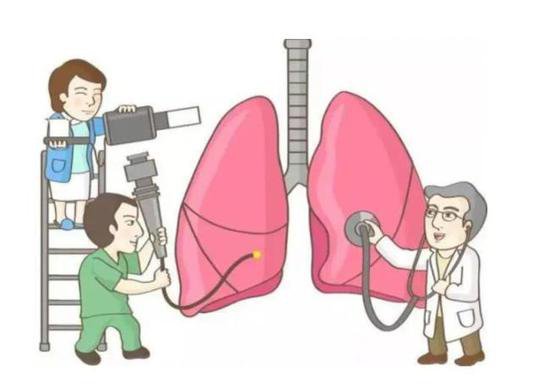 肺结节不等于肺癌 影像<em>检查怎么</em>评估？