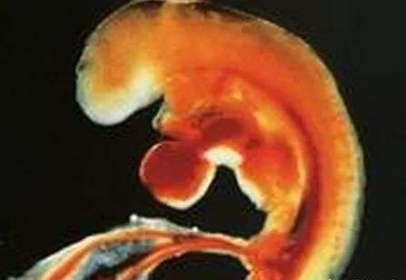 怀孕之后<em>什么</em>一直看不见“胎心胎芽”？
