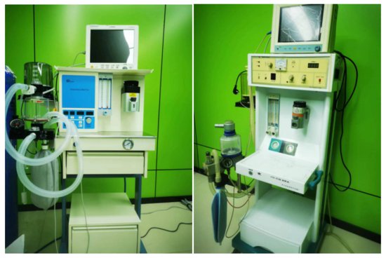 CV-290高清电子胃肠镜引进兰州中医胃肠医院