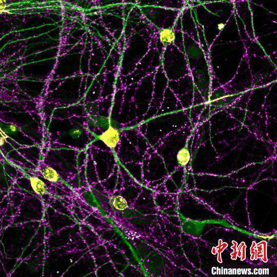 中国团队首揭神经元突触群体组织原则 或助抗衰老等新药研发