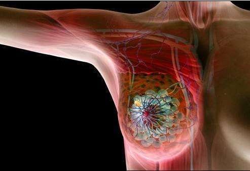 乳腺癌治疗过程中常见的不良<em>反应</em>及管理