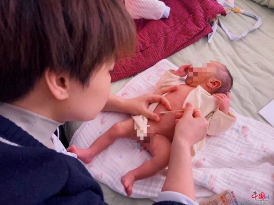 广元市妇幼保健院开展新生儿上门特色服务
