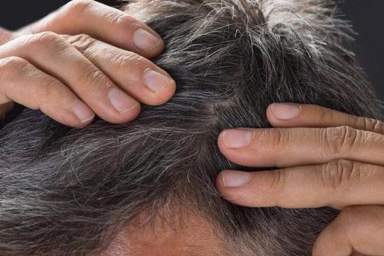 哈佛研究发现：长白头发的人不易患癌？<em>有科学依据吗</em>？告诉你...