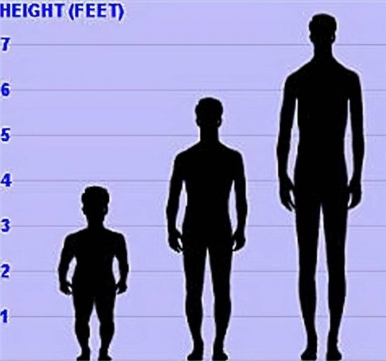 从侏儒到巨人，前半生身高1米22，后半生2米16，全球仅一人