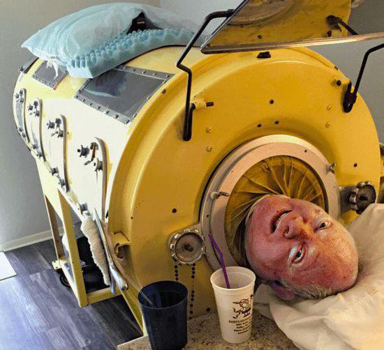 被困“铁桶”72年的铁肺人，一生无法呼吸，停电就意味着死亡