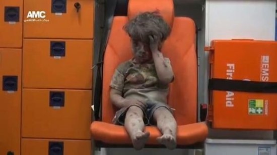 叙利亚男孩照震撼世界 美称其为战争<em>真实面目</em>