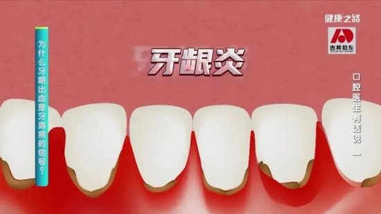 牙齿松动、敏感、<em>牙龈出血</em>……你的牙健康吗？
