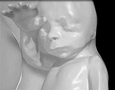 VR+磁共振让准爸妈“瞅瞅”<em>未出生的宝宝</em>