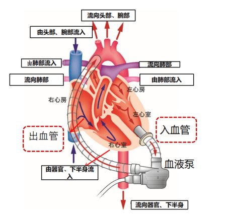 2020 CHDC | 胡盛寿院士：机械<em>循环</em>支持装置治疗心脏<em>衰竭的</em>中国...