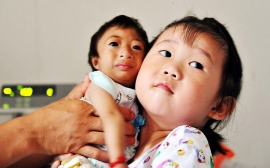 2009年，湖南女子生下2斤袖珍女婴，长相像猴子，马戏团出5万...